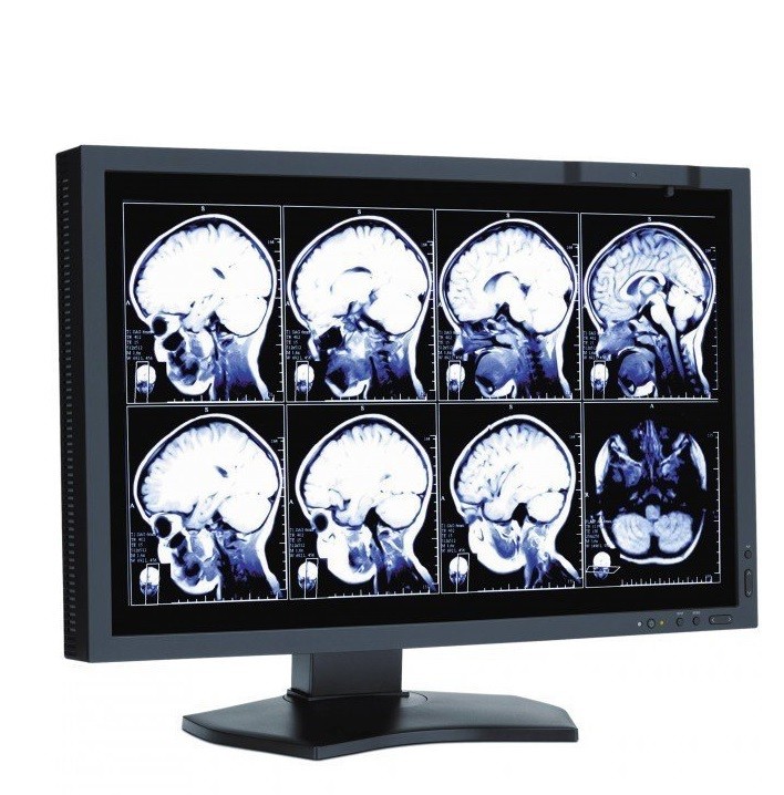 Zdravotnické displeje